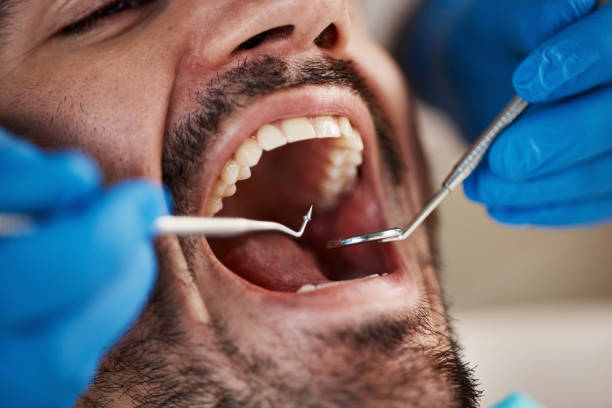 Best Emergency Dental Care for Broken or Chipped Teeth in Millville, DE