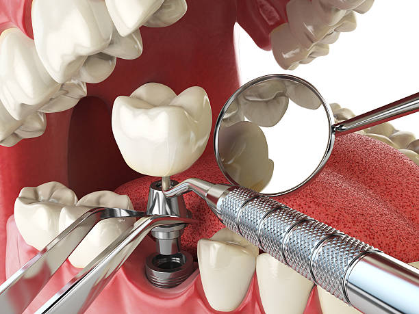 Reliable DE Emergency Dentist Solutions